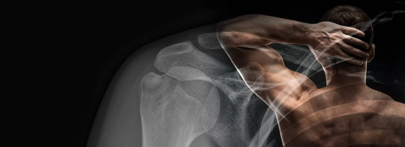 Banner image from the Sydney Shoulder Research Institute website